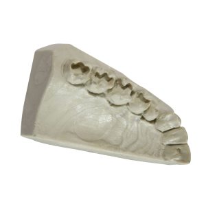 TIPODONTO DE 1/4 DE ARCADA PIEZA FIJA CON PREPARACION