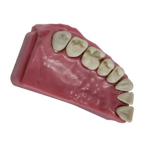 TIPODONTO DE 1/4 DE ARCADA PIEZA MOVIBLES CON PREPARACION